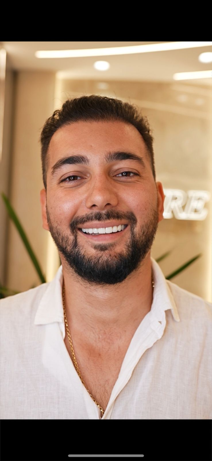 After - Hollywood Smile