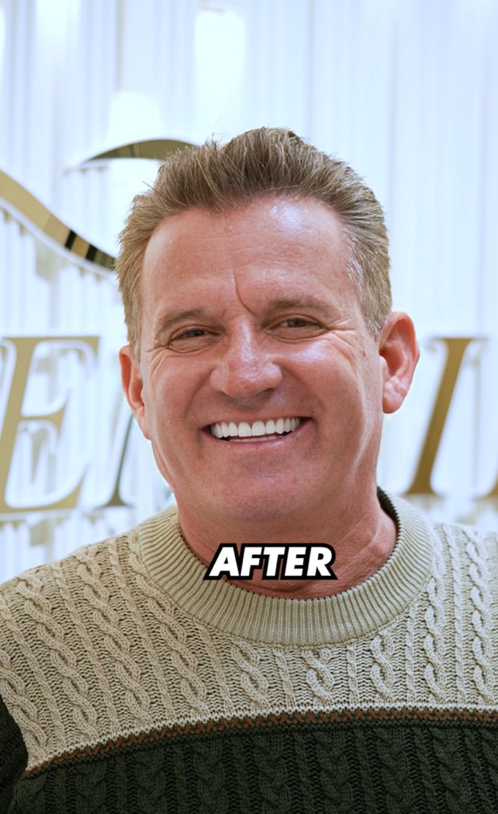 After - Dental Implants