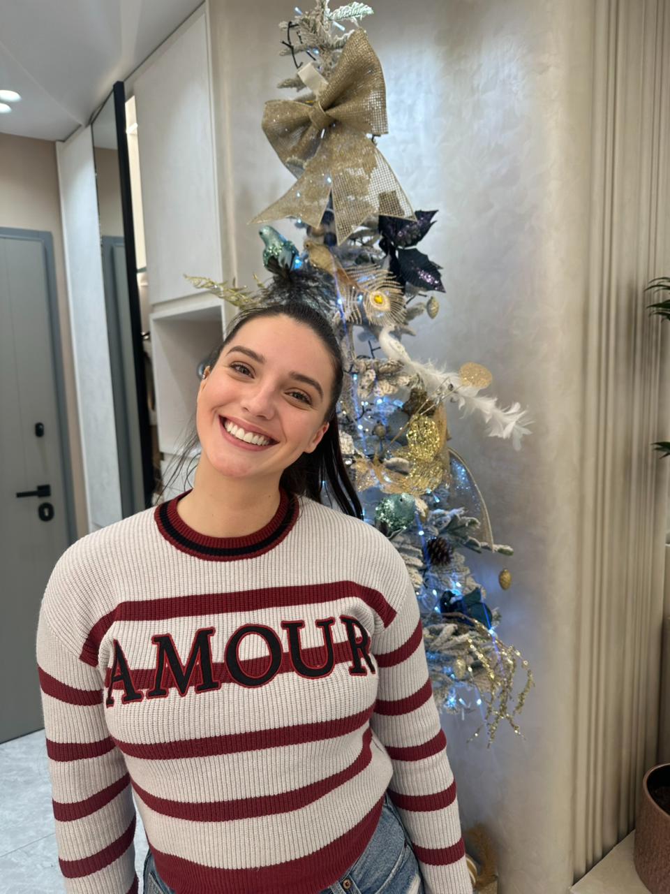 After - Porcelain Veneers