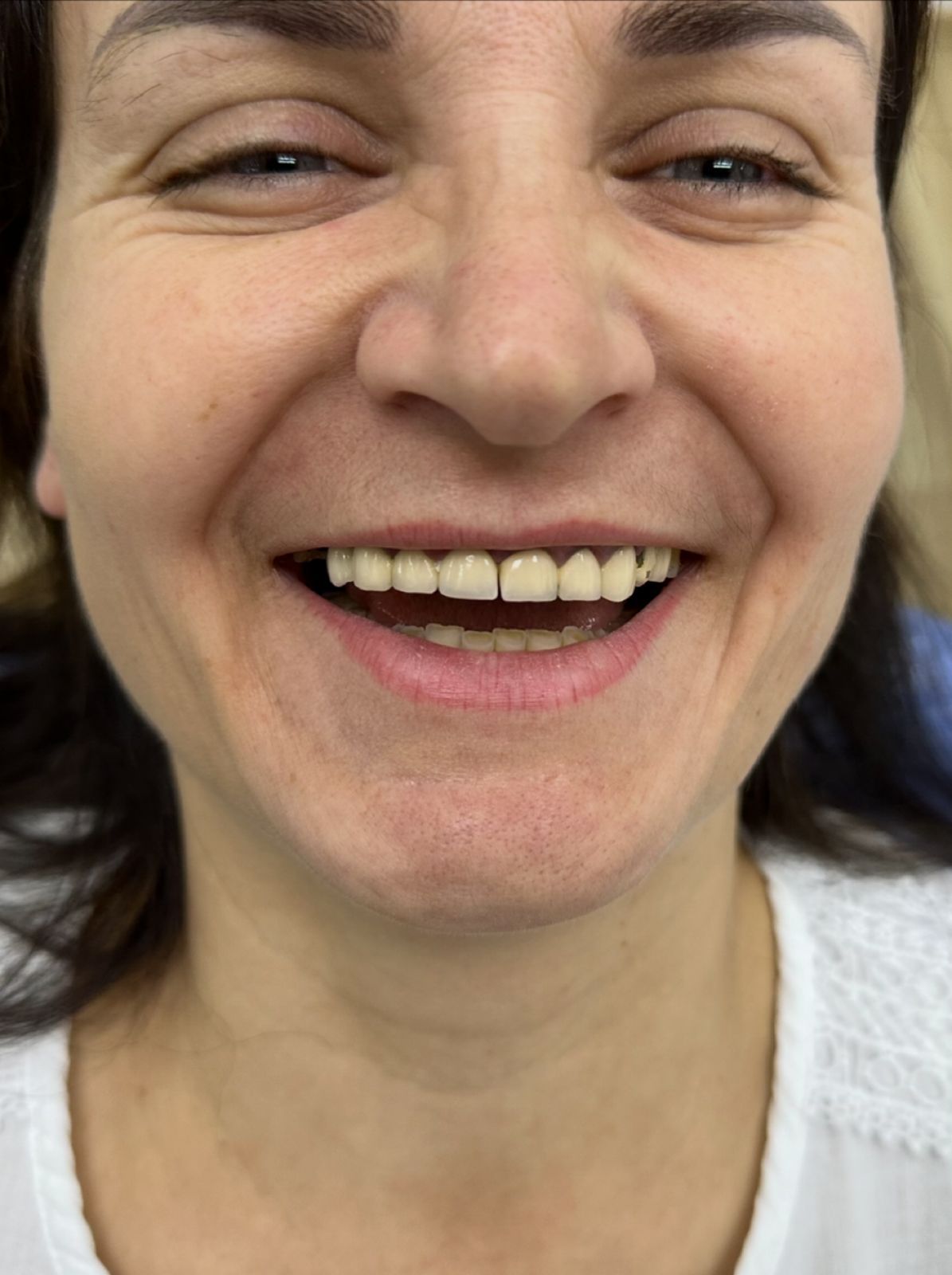 Prima - Hollywood Smile