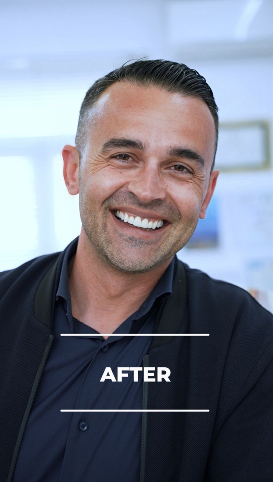 Prima - Hollywood Smile